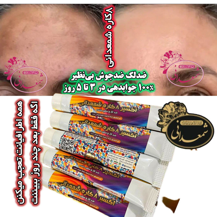 کرم ضدلک و ضدچروک ۸ کاره